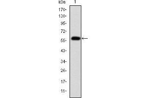 Western blot analysis using FGG mAb against human FGG (AA: 210-437) recombinant protein.