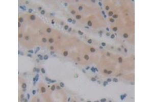 IHC-P analysis of Human Tissue, with DAB staining. (Polybromo 1 抗体  (AA 957-1086))