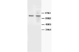 Western Blotting (WB) image for anti-BRCA1 Associated Protein-1 (Ubiquitin Carboxy-terminal Hydrolase) (BAP1) antibody (ABIN2155950) (BAP1 抗体)
