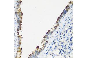 Immunohistochemistry of paraffin-embedded mouse lung using TNNC2 antibody at dilution of 1:200 (40x lens). (TNNC2 抗体)