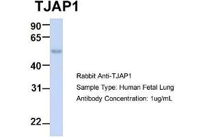Host:  Rabbit  Target Name:  TJAP1  Sample Type:  Human Fetal Lung  Antibody Dilution:  1. (TJAP1 抗体  (N-Term))