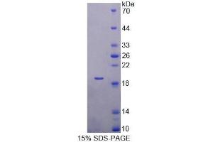SDS-PAGE analysis of Mouse TBCA Protein. (TBCA 蛋白)