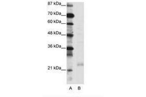 Image no. 1 for anti-TAF10 RNA Polymerase II, TATA Box Binding Protein (TBP)-Associated Factor, 30kDa (TAF10) (C-Term) antibody (ABIN6736086) (TAF10 抗体  (C-Term))