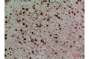 Immunohistochemistry (IHC) image for anti-Killer Cell Immunoglobulin-Like Receptor, three Domains, Long Cytoplasmic Tail, 3 (KIR3DL3) (Internal Region) antibody (ABIN6282363)