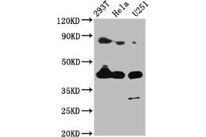 Western Blot Positive WB detected in: 293T whole cell lysate, Hela whole cell lysate, U251 whole cell lysate All lanes: MSTN antibody at 4 μg/mL Secondary Goat polyclonal to rabbit IgG at 1/50000 dilution Predicted band size: 43 kDa Observed band size: 43 kDa