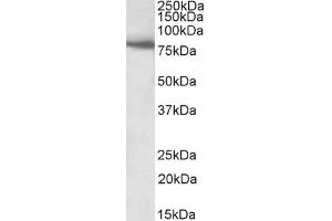 ABIN5539484 (1µg/ml) staining of Human Skeletal Muscle lysate (35µg protein in RIPA buffer).