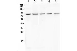 Western blot analysis of RNF43 using anti-RNF43 antibody . (RNF43 抗体  (AA 24-197))