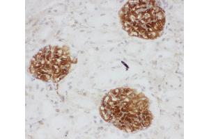 Anti-CD34 antibody, IHC(F) IHC(F): Rat Kidney Tissue