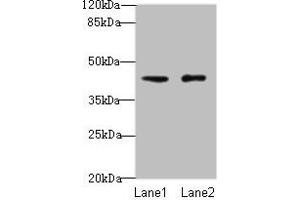 Western blot All lanes: VPS45 antibody at 3 μg/mL Lane 1: Mouse brain tissue Lane 2: U87 whole cell lysate Secondary Goat polyclonal to rabbit IgG at 1/10000 dilution Predicted band size: 66, 62 kDa Observed band size: 41 kDa (VPS45 抗体  (AA 101-400))