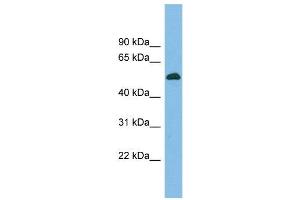 WB Suggested Anti-BRUNOL5 Antibody Titration:  0. (CELF5 抗体  (Middle Region))
