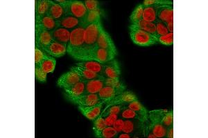 Immunofluorescence Analysis of MeOH-fixed Human MCF-7 cells labeling CK with Multi-Cytokeratin Recombinant Rabbit Monoclonal Antibody (KRT/1877R)followed by Goat anti-Mouse IgG-CF488 (Green). (Recombinant Cytokeratin, Multi (Epithelial Marker) 抗体)