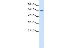 WB Suggested Anti-ZNF12 Antibody Titration:  1. (ZNF12 抗体  (N-Term))