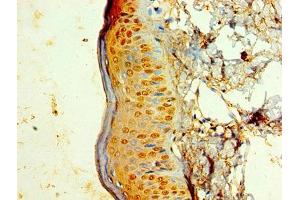 Immunohistochemistry of paraffin-embedded human skin tissue using ABIN7157433 at dilution of 1:100 (KRT6A 抗体  (AA 2-564))