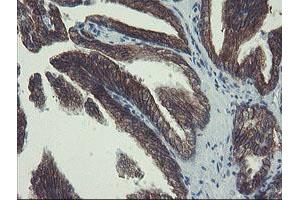 Image no. 14 for anti-Diphthamide Biosynthesis Protein 2 (DPH2) antibody (ABIN1497891)