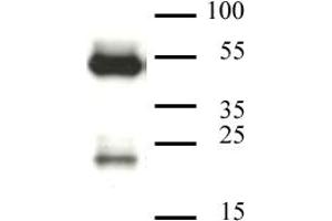 CAF-1 p60 antibody (mAb) tested by Western blot. (CHAF1B 抗体)