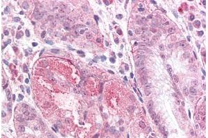Human Stomach: Formalin-Fixed, Paraffin-Embedded (FFPE) (TMEM33 抗体  (Internal Region))