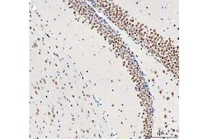IHC analysis of DDX1 using anti-DDX1 antibody (ABIN7602052). (DDX1 抗体  (AA 562-740))