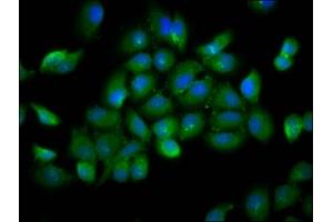 Immunofluorescence staining of A549 cells with ABIN7174389 at 1:166, counter-stained with DAPI. (YOD1 抗体  (AA 1-44))