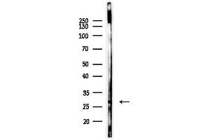 anti-RAB, Member of RAS Oncogene Family-Like 2A (RABL2A) (C-Term) antibody
