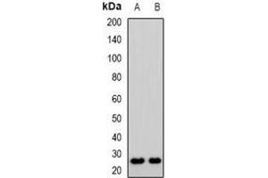 Western blot analysis of CD53 expression in KB (A), Jurkat (B) whole cell lysates. (CD53 抗体)