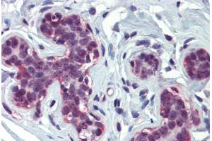 Breast, Human: Formalin-Fixed, Paraffin-Embedded (FFPE) (CBP 抗体  (AA 144-193))