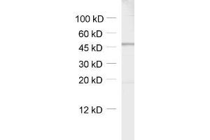 dilution: 1 : 1000, sample: rat brain homogenate (GABRB3 抗体)