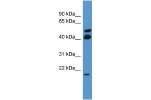 WB Suggested Anti-RERG Antibody Titration: 0. (RERG 抗体  (C-Term))