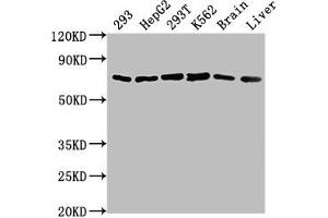 Western Blot Positive WB detected in: 293 whole cell lysate, HepG2 whole cell lysate, 293T whole cell lysate, K562 whole cell lysate, Mouse brain tissue, Mouse liver tissue All lanes: HSPD1 antibody at 1:2000 Secondary Goat polyclonal to rabbit IgG at 1/50000 dilution Predicted band size: 62, 18 kDa Observed band size: 62 kDa