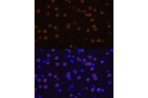 Immunofluorescence analysis of mouse brain using MEF2C Polyclonal Antibody (ABIN6132345, ABIN6143716, ABIN6143717 and ABIN6215998) at dilution of 1:100 (40x lens). (MEF2C 抗体  (AA 170-380))