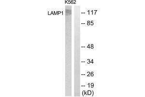 Western blot analysis of extracts from K562 cells, using LAMP1 antibody. (LAMP1 抗体  (Internal Region))