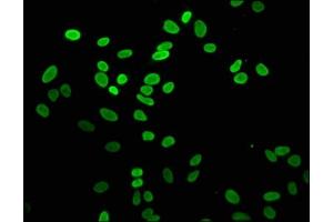 Immunofluorescence staining of Hela cells with ABIN7139600 at 1:5, counter-stained with DAPI. (H2AFZ 抗体  (meLys4))