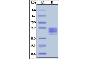 Mouse CD16-2, His Tag on  under reducing (R) condition.