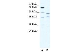 TRIM23 antibody (20R-1190) used at 0. (TRIM23 抗体  (C-Term))