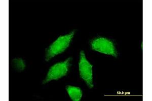 Immunofluorescence (IF) image for anti-Wingless-Type MMTV Integration Site Family, Member 3A (WNT3A) (AA 1-385) antibody (ABIN529925)