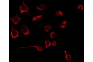 ABIN6275753 staining 293 by IF/ICC. (PLAGL1 抗体  (Internal Region))