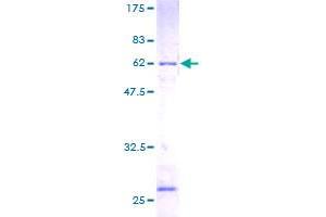 SDS-PAGE (SDS) image for Ribosomal Protein, Large, P0 (RPLP0) (AA 1-317) protein (GST tag) (ABIN1318678)