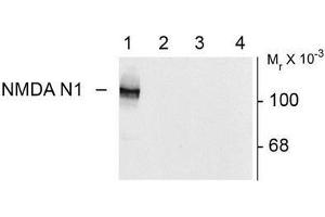 Image no. 1 for anti-NMDA Receptor 1 (NMDA R1) (Splice Variant N1) antibody (ABIN372678) (NMDA 1 Receptor 抗体  (Splice Variant N1))