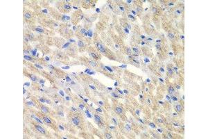 Immunohistochemistry of paraffin-embedded Mouse heart using CARS Polyclonal Antibody at dilution of 1:100 (40x lens). (CARS 抗体)