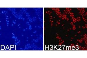 Immunofluorescence analysis of 293T cell using H3K27me3 antibody. (Histone 3 抗体  (H3K27me3))