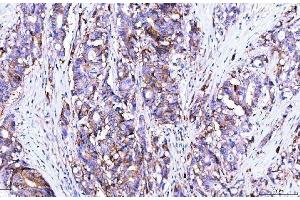 IHC analysis of Poliovirus Receptor/PVR using anti-Poliovirus Receptor/PVR antibody (ABIN7601072). (Poliovirus Receptor 抗体  (AA 28-331))