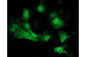 Anti-CDK2 mouse monoclonal antibody (ABIN2454507) immunofluorescent staining of COS7 cells transiently transfected by pCMV6-ENTRY CDK2 (RC200494). (CDK2 抗体)