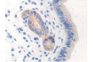 IHC-P analysis of Mouse Uterus Tissue, with DAB staining. (NOS1 抗体  (AA 53-247))