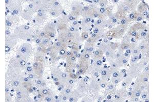 ABIN6268710 at 1/100 staining human liver tissue sections by IHC-P.