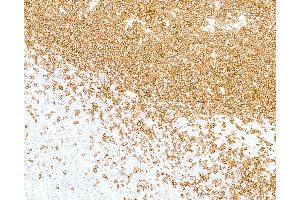 Immunohistochemistry (IHC) image for anti-Fluorescein Isothiocyanate (FITC) antibody (ABIN7795714) (Recombinant FITC 抗体)