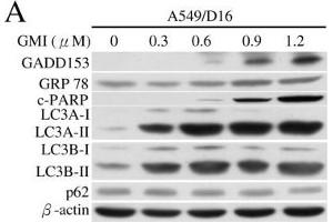 Western Blotting (WB) image for anti-Sequestosome 1 (SQSTM1) antibody (ABIN2854836)