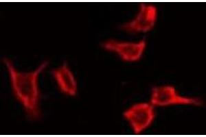Immunofluorescence (fixed cells) (IF/ICC) image for anti-Coronin, Actin Binding Protein, 1A (CORO1A) (Internal Region) antibody (ABIN6259628)