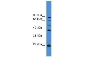 WB Suggested Anti-ASCL2  Antibody Titration: 0. (ASCL2 抗体  (C-Term))
