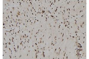 ABIN6273014 at 1/100 staining Rat heart tissue by IHC-P. (RNH1 抗体  (Internal Region))