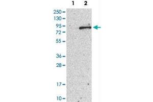 Western Blot analysis of Lane 1: negative control (vector only transfected HEK293T cell lysate) and Lane 2: over-expression lysate (co-expressed with a C-terminal myc-DDK tag in mammalian HEK293T cells) with TEC polyclonal antibody . (NR4A3 抗体)