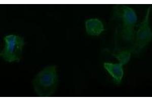 Image no. 2 for anti-Retinoic Acid Receptor Responder (Tazarotene Induced) 1 (RARRES1) antibody (ABIN1500603)